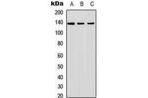 Western blot analysis of SHIP2 expression in A549 (A), NS-1 (B), PC12 (C) whole cell lysates.