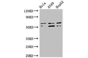Western Blot Positive WB detected in: Hela whole cell lysate, A549 whole cell lysate, HepG2 whole cell lysate All lanes: COQ8B antibody at 3 μg/mL Secondary Goat polyclonal to rabbit IgG at 1/50000 dilution Predicted band size: 61, 56 kDa Observed band size: 61, 56 kDa (COQ8B 抗体  (AA 10-137))