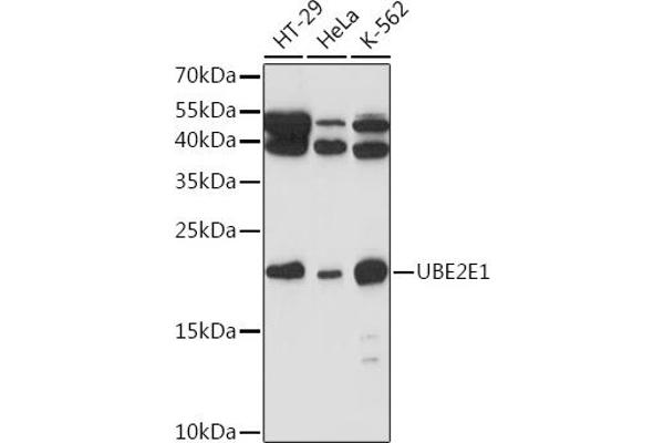 UBE2E1 抗体  (AA 1-193)