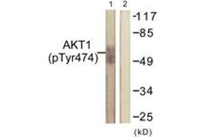 Western blot analysis of extracts from COS7 cells treated with UV 15', using Akt (Phospho-Tyr474) Antibody. (AKT1 抗体  (pTyr474))