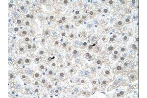 anti-Nuclear Receptor Subfamily 1, Group I, Member 3 (NR1I3) (C-Term) antibody