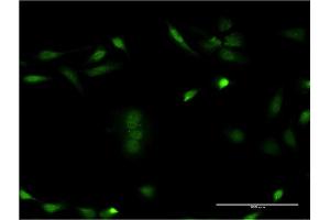 Immunofluorescence of monoclonal antibody to CSNK1E on HeLa cell. (CK1 epsilon 抗体  (AA 2-100))