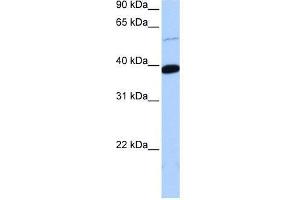 ZNF562 antibody used at 0. (ZNF562 抗体  (Middle Region))