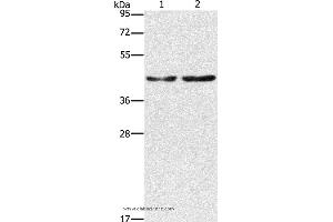 Western blot analysis of Hela and 293T cell, using CBX6 Polyclonal Antibody at dilution of 1:600 (CBX6 抗体)