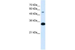 Western Blot showing A1BG antibody used at a concentration of 1-2 ug/ml to detect its target protein. (A1BG 抗体  (N-Term))