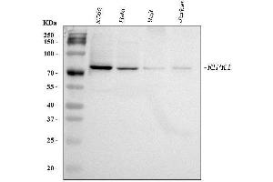 Western blot analysis of RIPK1 using anti-RIPK1 antibody (ABIN3042930).