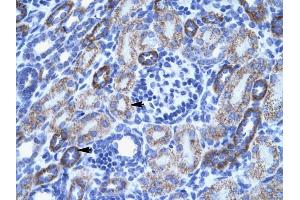 ACCN3 antibody was used for immunohistochemistry at a concentration of 4-8 ug/ml to stain Epithelial cells of renal tubule (arrows) in Human Kidney. (ASIC3 抗体  (N-Term))