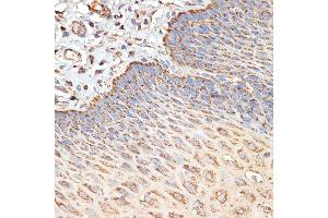 Immunohistochemistry of paraffin-embedded human esophageal using TSC2 Rabbit pAb (ABIN6128542, ABIN6149611, ABIN6149612 and ABIN6213862) at dilution of 1:100 (40x lens). (Tuberin 抗体  (AA 900-1150))