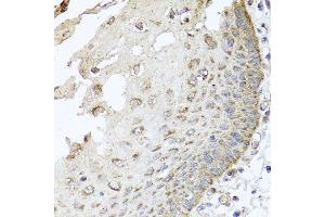 Immunohistochemistry of paraffin-embedded human esophagus using IRS2 antibody at dilution of 1:100 (x40 lens).