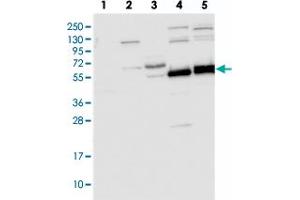 Western blot analysis of Lane 1: RT-4, Lane 2: U-251 MG, Lane 3: Human Plasma, Lane 4: Liver, Lane 5: Tonsil with TRIM7 polyclonal antibody  at 1:250-1:500 dilution. (TRIM7 抗体)
