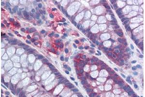 Human Colon: Formalin-Fixed, Paraffin-Embedded (FFPE) (G3BP1 抗体  (AA 214-303))