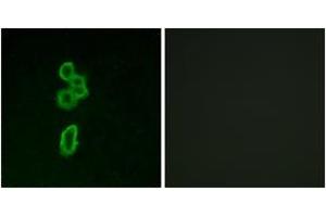 Immunofluorescence analysis of MCF7 cells, using FZD6 Antibody. (FZD6 抗体  (AA 116-165))