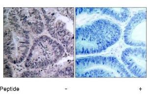Image no. 1 for anti-conserved Helix-Loop-Helix Ubiquitous Kinase (CHUK) (Thr23) antibody (ABIN197306) (IKK alpha 抗体  (Thr23))