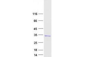 Western Blotting (WB) image for RAN, Member RAS Oncogene Family (RAN) protein (Myc-DYKDDDDK Tag) (ABIN2730449)