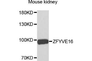 Western blot analysis of extracts of mouse kidney, using ZFYVE16 antibody.