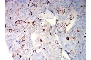Immunohistochemistry (IHC) image for anti-Neural Cell Adhesion Molecule 1 (NCAM1) antibody (ABIN7193604)