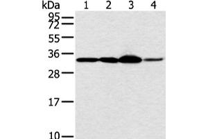 Western blot analysis of Hela and PC3 cell 231 cell and human esophagus cancer tissue using MED6 Polyclonal Antibody at dilution of 1:400 (MED6 抗体)