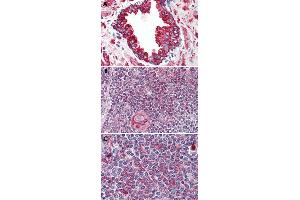 Immunohistochemical staining of formalin-fixed, paraffin-embedded human prostate (A), human thymus (B) and human spleen (C) tissue after heat-induced antigen retrieval. (WNT5B 抗体  (Internal Region))
