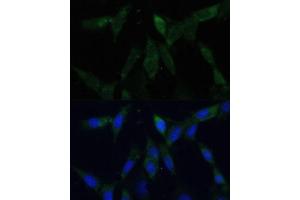 Immunofluorescence analysis of NIH-3T3 cells using ZWINT Polyclonal Antibody (ABIN6128944, ABIN6150552, ABIN6150554 and ABIN6221938) at dilution of 1:100 (40x lens). (ZWINT 抗体  (AA 1-277))