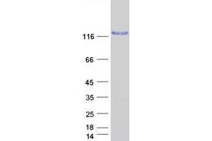 Western Blotting (WB) image for Eukaryotic Translation Initiation Factor 2-alpha Kinase 3 (EIF2AK3) protein (Myc-DYKDDDDK Tag) (ABIN2720059)