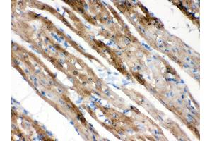 Anti- FXYZ1 Picoband antibody, IHC(P) IHC(P): Rat Cardiac Muscle Tissue (FXYD1 抗体  (AA 21-92))