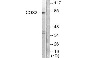 Western blot analysis of extracts from A549 cells, using Cox2 antibody. (COX2 抗体)