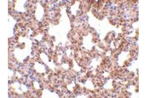 Immunohistochemistry of TRPC6 in mouse lung tissue with TRPC6 polyclonal antibody  at 10 ug/mL . (TRPC6 抗体  (C-Term))