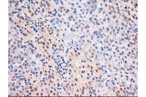 Image no. 8 for anti-Myc Proto-Oncogene protein (MYC) antibody (ABIN1497013) (c-MYC 抗体)