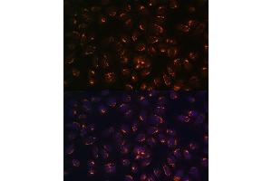 Immunofluorescence (IF) image for anti-UDP-N-Acetyl-alpha-D-Galactosamine:polypeptide N-Acetylgalactosaminyltransferase 2 (GalNAc-T2) (GALNT2) (AA 442-571) antibody (ABIN6140940)