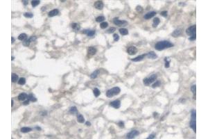 Immunohistochemistry (IHC) image for anti-Arylsulfatase A (ARSA) antibody (ABIN7441370)