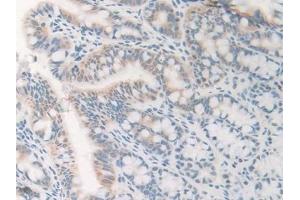 Detection of GnRH in Mouse Small intestine Tissue using Polyclonal Antibody to Gonadotropin Releasing Hormone (GnRH)