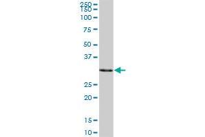 Western Blotting (WB) image for anti-Sulfotransferase Family, Cytosolic, 1A, Phenol-Preferring, Member 3 (SULT1A3) (AA 1-295) antibody (ABIN520608)