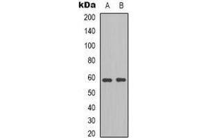 Western blot analysis of BLK expression in HepG2 (A), HEK293T (B) whole cell lysates.