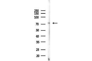 Western blot analysis of lysates from Rat liver, using Lactoferrin Antibody at 1/1000 dilution.