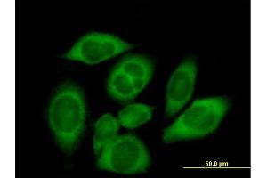 Immunofluorescence of purified MaxPab antibody to CARS on HeLa cell. (CARS 抗体  (AA 1-748))