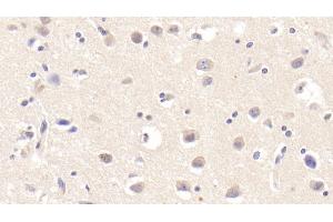 Immunohistochemistry (IHC) image for anti-tyrosine Kinase with Immunoglobulin-Like and EGF-Like Domains 1 (TIE1) (AA 435-609) antibody (ABIN7442504)