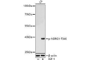 Western blot analysis of extracts of C6 cells, using Phospho-NDRG1-T346 antibody (ABIN7268785) at 1:1000 dilution. (NDRG1 抗体  (pThr346))