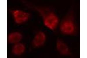 ABIN6274517 staining Hela cells by IF/ICC. (ARNT2 抗体  (N-Term))