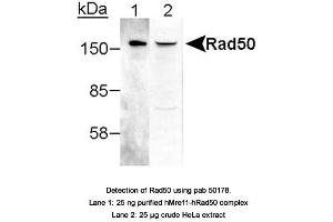 Image no. 1 for anti-RAD50 Homolog (S. Cerevisiae) (RAD50) antibody (ABIN363487) (RAD50 抗体)