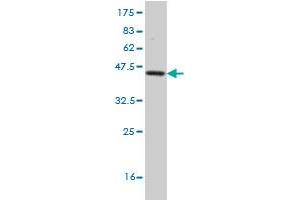 Western Blot detection against Immunogen (37. (Frataxin 抗体  (AA 91-200))