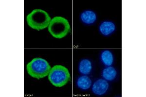 Immunofluorescence staining of fixed RAW264. (Recombinant CCRL2 抗体  (AA 1-24))