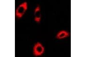 Immunofluorescent analysis of PHACS staining in A549 cells. (PHACS 抗体)