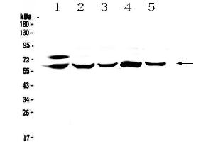 Western blot analysis of CES1 using anti-CES1 antibody .