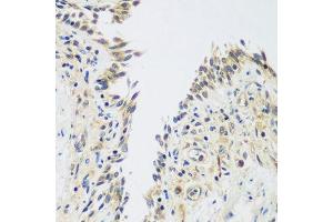 Immunohistochemistry of paraffin-embedded human lung using UPF2 antibody. (RENT2/UPF2 抗体  (AA 1153-1272))