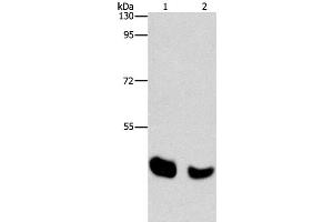 Western Blot analysis of Human normal liver and Mouse pancreas tissue using BAAT Polyclonal Antibody at dilution of 1:650