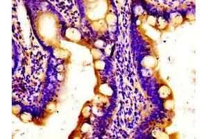 Immunohistochemistry of paraffin-embedded human small intestine tissue using ABIN7150152 at dilution of 1:100 (APOBEC3D 抗体  (AA 250-371))
