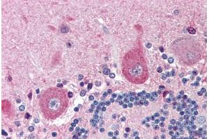 Human Brain, Cerebellum (formalin-fixed, paraffin-embedded) stained with NGFR antibody ABIN214454 at 5 ug/ml followed by biotinylated goat anti-rabbit IgG secondary antibody ABIN481713, alkaline phosphatase-streptavidin and chromogen. (NGFR 抗体)