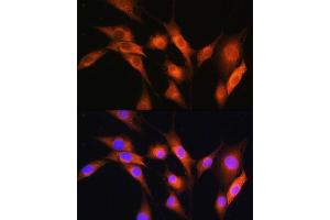 Immunofluorescence analysis of NIH/3T3 cells using  Rabbit pAb (ABIN7265658) at dilution of 1:100. (ARCN1 抗体  (AA 212-511))