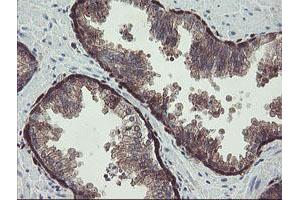 Image no. 1 for anti-TSC22 Domain Family, Member 1 (TSC22D1) antibody (ABIN1501540) (TSC22D1 抗体)