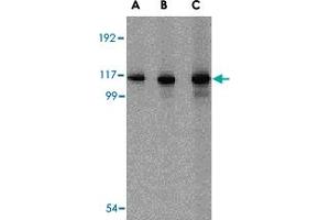 Western blot analysis of IFIH1 in Daudi cell lysate with IFIH1 polyclonal antibody  at (A) 1, (B) 2 and (C) 4 ug/mL . (IFIH1 抗体  (C-Term))